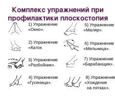 ploskostopie_3_thumb32.jpg
